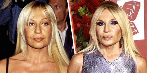 vestiti donna marca versus di versace|what happened to donatella versace's face.